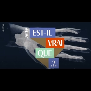 [Serie] Est-il vrai que... ?